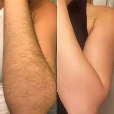 Beyond impressed with the results!